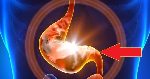 La hernia intervertebral del departamento lumbar el tratamiento en saratove